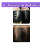 مزونیدلینگ‌ و فیشال احمدی