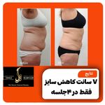 کلینیک زیبایی ،لیزر و لاغری گل مریم