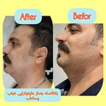 مطب پوست ،مو و لیزر یسنا طب