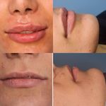 کلینیک پوست مو زیبایی آرا