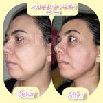 مطب پوست ،مو و لیزر یسنا طب