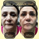 مطب پوست ،مو و لیزر یسنا طب