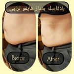 مطب پوست ،مو و لیزر یسنا طب