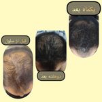 مطب پوست ،مو و لیزر یسنا طب
