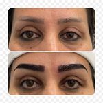 کاشت مو و ابرو کرج