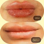 مطب پوست ،مو و لیزر یسنا طب