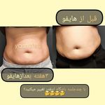 مطب پوست ،مو و لیزر یسنا طب