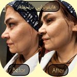 مطب پوست ،مو و لیزر یسنا طب