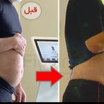 مرکز لاغری موضعی و ایکس بادی فیت اسمارت