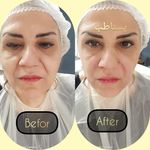 مطب پوست ،مو و لیزر یسنا طب