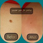 مطب پوست ،مو و لیزر یسنا طب
