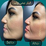 مطب پوست ،مو و لیزر یسنا طب