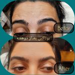 مطب پوست ،مو و لیزر یسنا طب