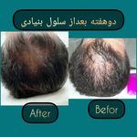 مطب پوست ،مو و لیزر یسنا طب