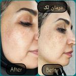 مطب پوست ،مو و لیزر یسنا طب