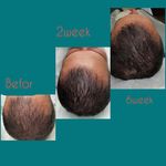 مطب پوست ،مو و لیزر یسنا طب