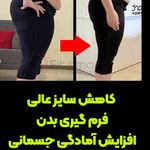 مرکز لاغری موضعی و ایکس بادی فیت اسمارت