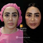 مطب پوست مو لیزر و زیبایی لارا