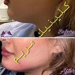 کلینیک پوست مو زیبایی مریم نیاوران