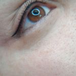 تتو و ریموو تتو درسا