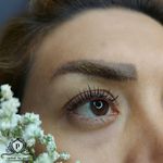 کاشت مژه(پریسا)