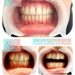 مركز دندانپزشکی دکترفرنوش عیوضی