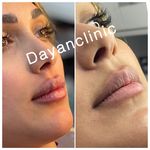 کلینیک لیزر و زیبایی دایان