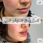 مرکز لیزر و کلینیک زیبایی دکتر با حجب