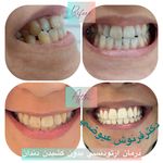 مركز دندانپزشکی دکترفرنوش عیوضی