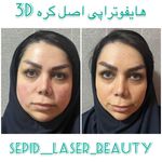 مرکز لیزر و کلینیک پوست مو زیبایی سپید