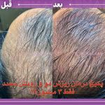 پزشک زیبایی دکتر ارمغان صادقی