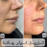 مرکز لیزر و کلینیک زیبایی دکتر با حجب