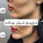 مرکز لیزر و کلینیک زیبایی دکتر با حجب