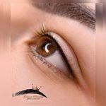 میکروبلیدینگ میکروپیگمنیشن و ریمو گلنسا