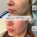 مرکز لیزر و کلینیک زیبایی دکتر با حجب