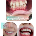 مركز دندانپزشکی دکترفرنوش عیوضی