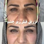 کلینیک زیبایی، لیزر و تغذیه دکتر حسنلو
