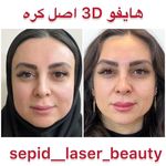 مرکز لیزر و کلینیک پوست مو زیبایی سپید