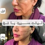 مرکز لیزر و کلینیک زیبایی دکتر با حجب