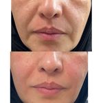 کلینیک پوست مو لیزر و لاغری عصر زیبایی