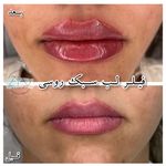 کلینیک زیبایی متانویا