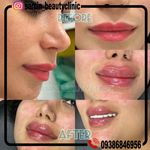 کلینیک پوست مو زیبایی و لیزر ثمین