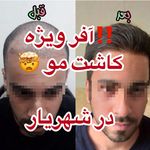 کلینیک لیزر و زیبایی دایان