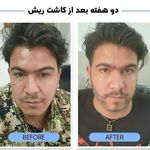 کلینیک تخصصی  پوست مو زیبایی تندیس سلامت