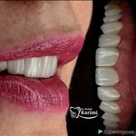 دندانپزشکی و ایمپلنت دکتر مهدی کریمی