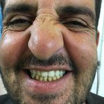 دندانسازی محلات (فتح المبین )