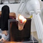 کلینیک تخصصی درمان زخم تلما گرگان