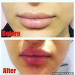 مرکز لاغری و کلینیک لاغری فوق سریع مقدم