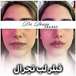 کلینیک زیبایی دکتر پریسا جلالی