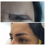 ارائه ی خدمات تخصصی میکروبلیدینگ و میکروپیگمنتیشن